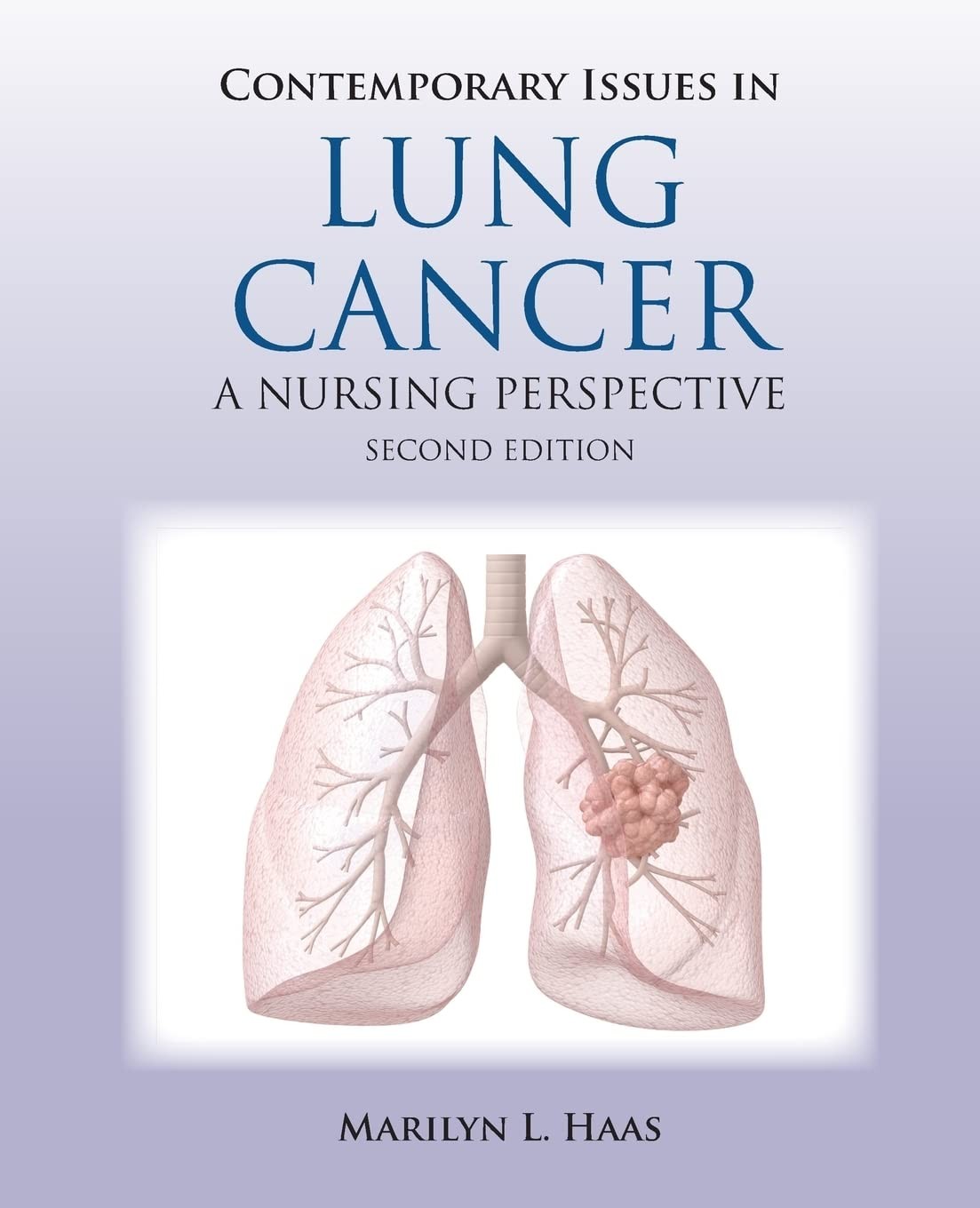 Contemporary Issues in Lung Cancer: .